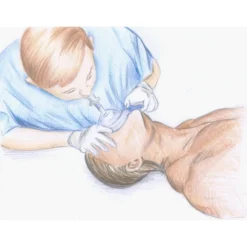 Magasin Aqualunged -Magasin Aqualunged pocket mask silicone pour bouche a bouche esm pas cher palanquee sub odyssee lyon 1